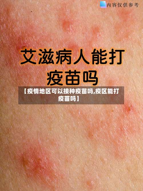 【疫情地区可以接种疫苗吗,疫区能打疫苗吗】-第2张图片