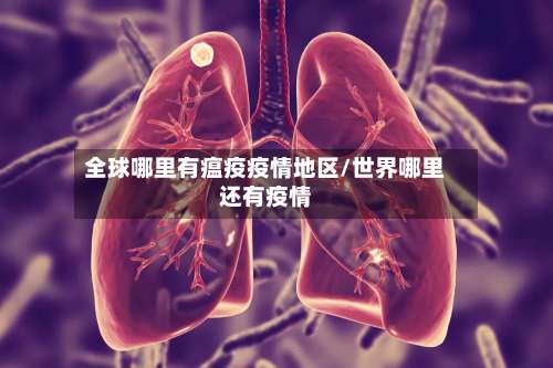 全球哪里有瘟疫疫情地区/世界哪里还有疫情-第1张图片