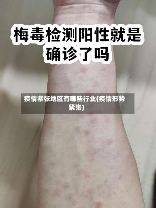 疫情紧张地区有哪些行业(疫情形势紧张)-第1张图片