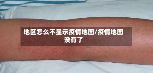 地区怎么不显示疫情地图/疫情地图没有了-第3张图片