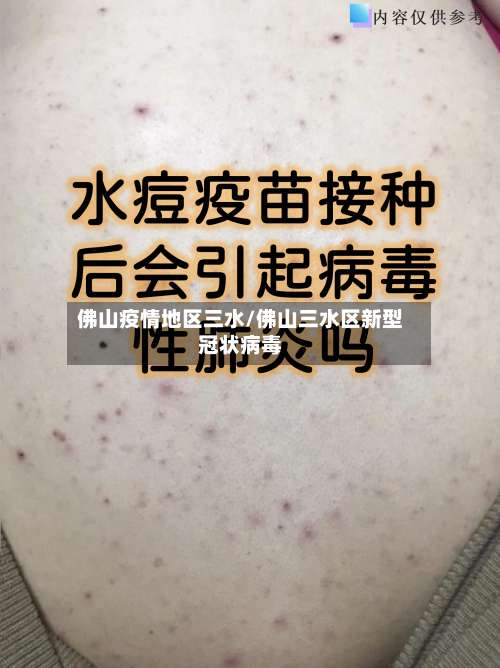 佛山疫情地区三水/佛山三水区新型冠状病毒-第3张图片