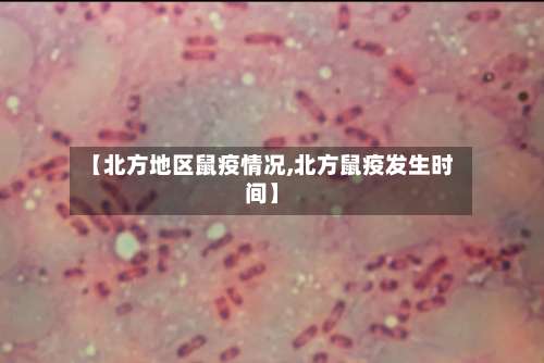【北方地区鼠疫情况,北方鼠疫发生时间】-第3张图片